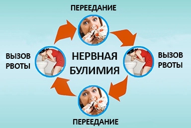 Лечение булимии в Нытве